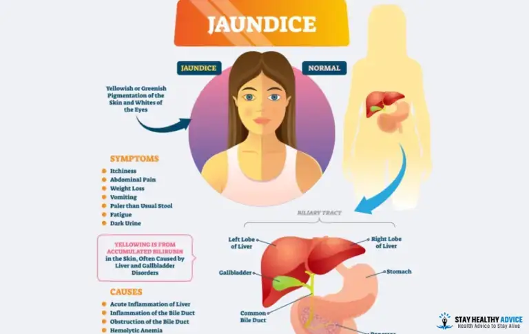 How is Jaundice Diagnosed