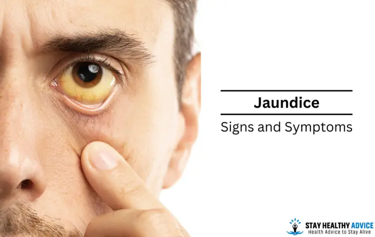 What are Signs and Symptoms of Jaundice