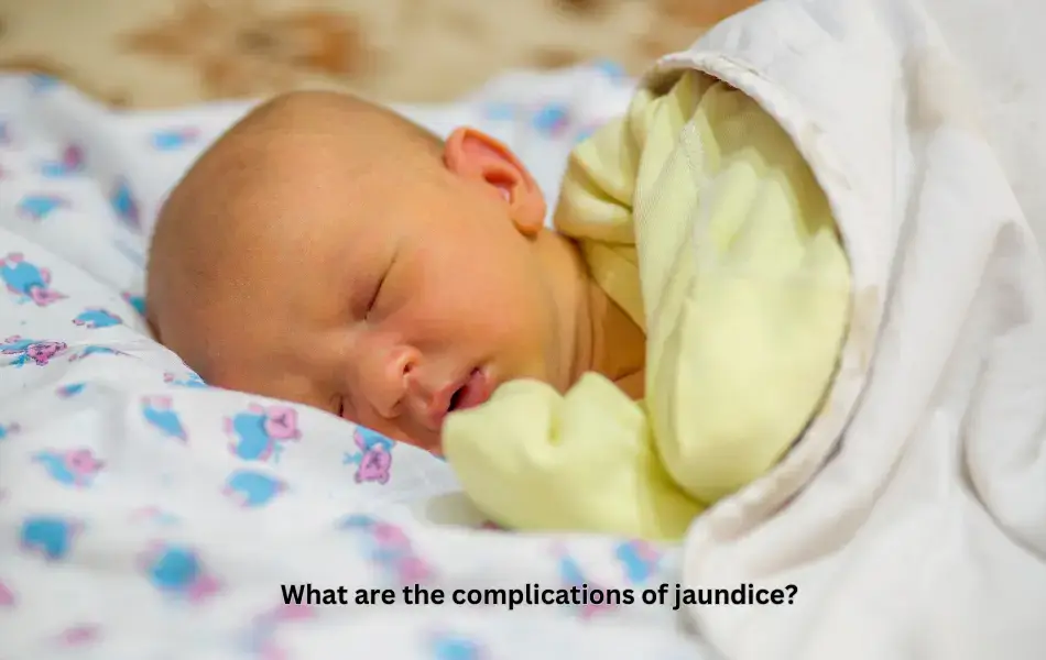 What are the Complications of Jaundice