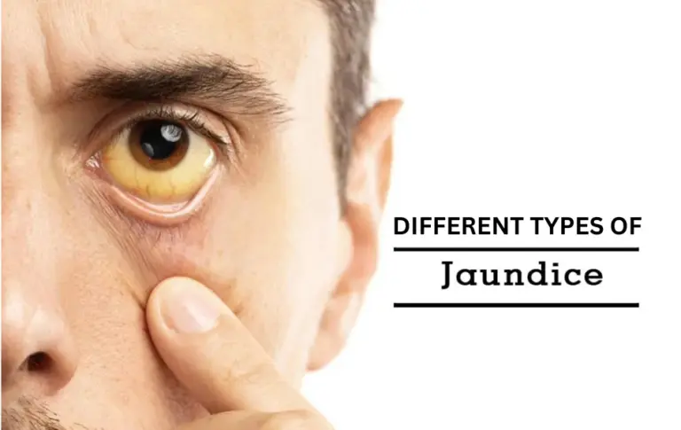 What are the Different Types of Jaundice