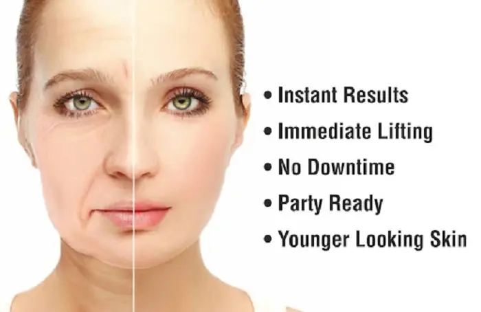 Benefits of Nonsurgical Facelift