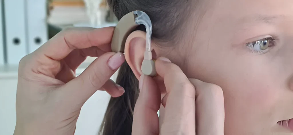 Cochlear Implants for Hearing