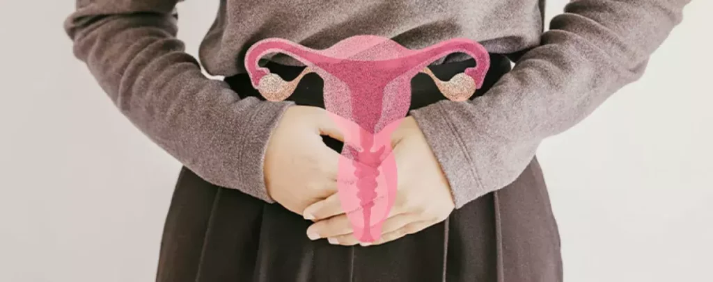 endometriosis