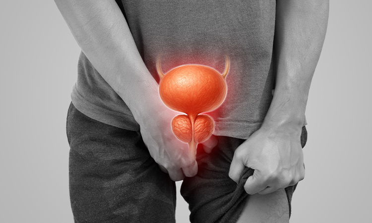 Prostate Cancer in Ahmedabad