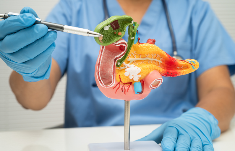 What to Know About Pancreatic Cancer in Ahmedabad