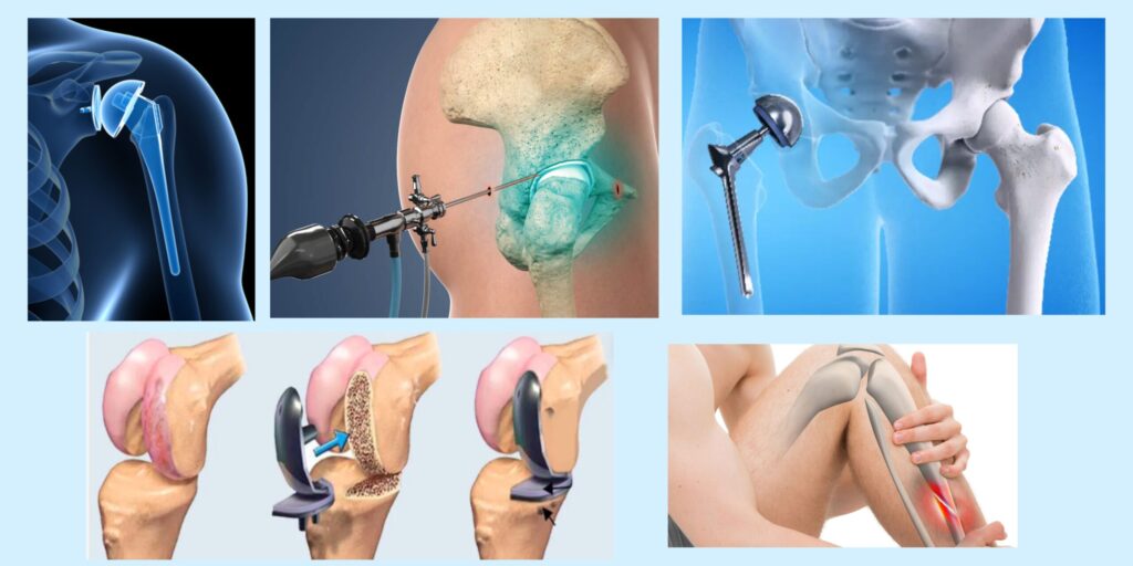 Everything You Need to Know Before Visiting an Orthopedic Doctor in Faridabad